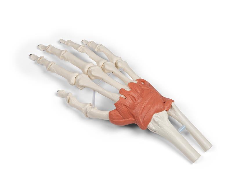 Produktbild Bandapparat des Handgelenks