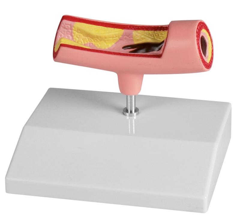 Produktbild Arterienmodell