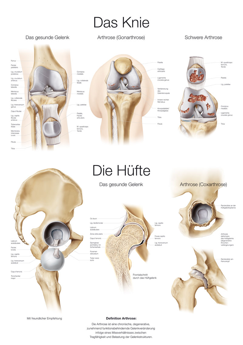 Lehrtafel "Das Knie / Die Hüfte" (deutsch), 50 x 70 cm Produktbild Lehrtafel "Das Knie / Die Hüfte" (deutsch), 50 x 70 cm