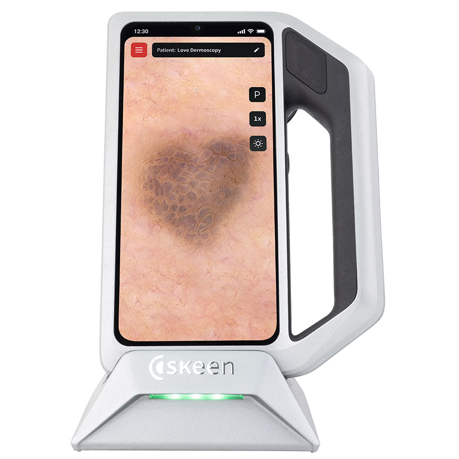 FotoFinder skeen Dermatoskop, Weiß