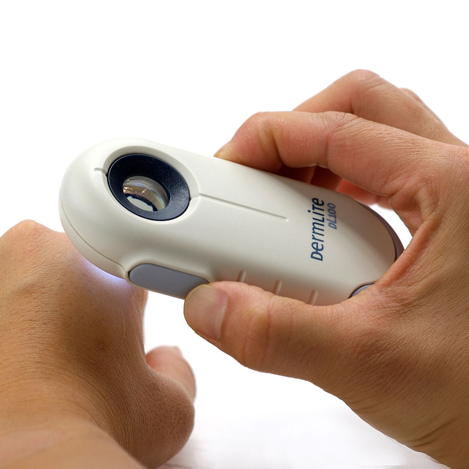 DermLite DL100 Dermatoskop, Weiß